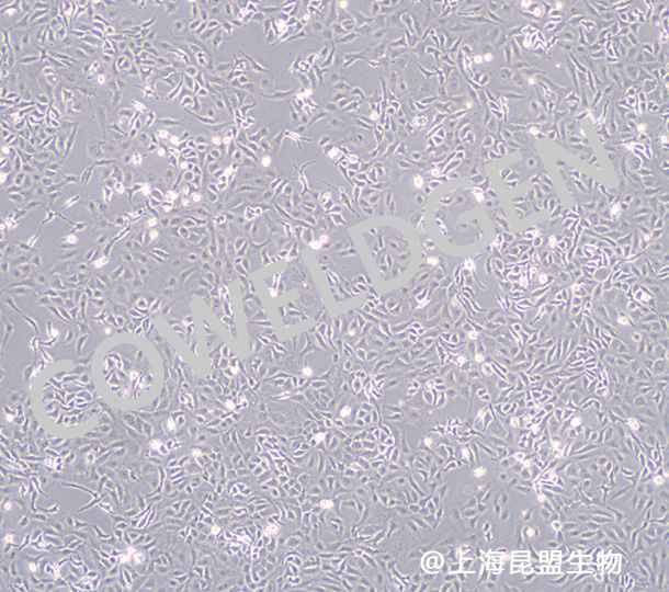 SK-OV-3 人卵巢癌细胞