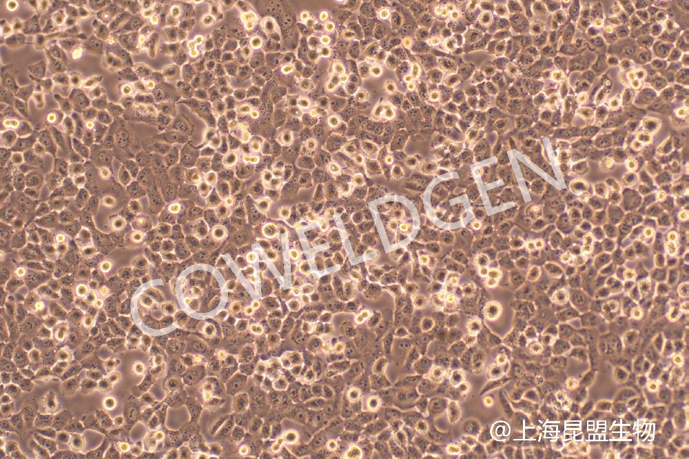 NCI-H1299 人非小细胞肺癌细胞
